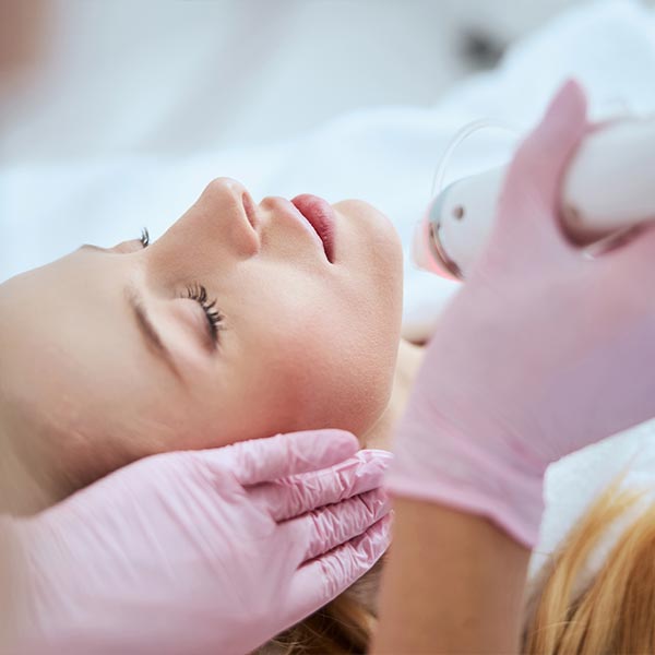 Secret RF Micro-needling best provider